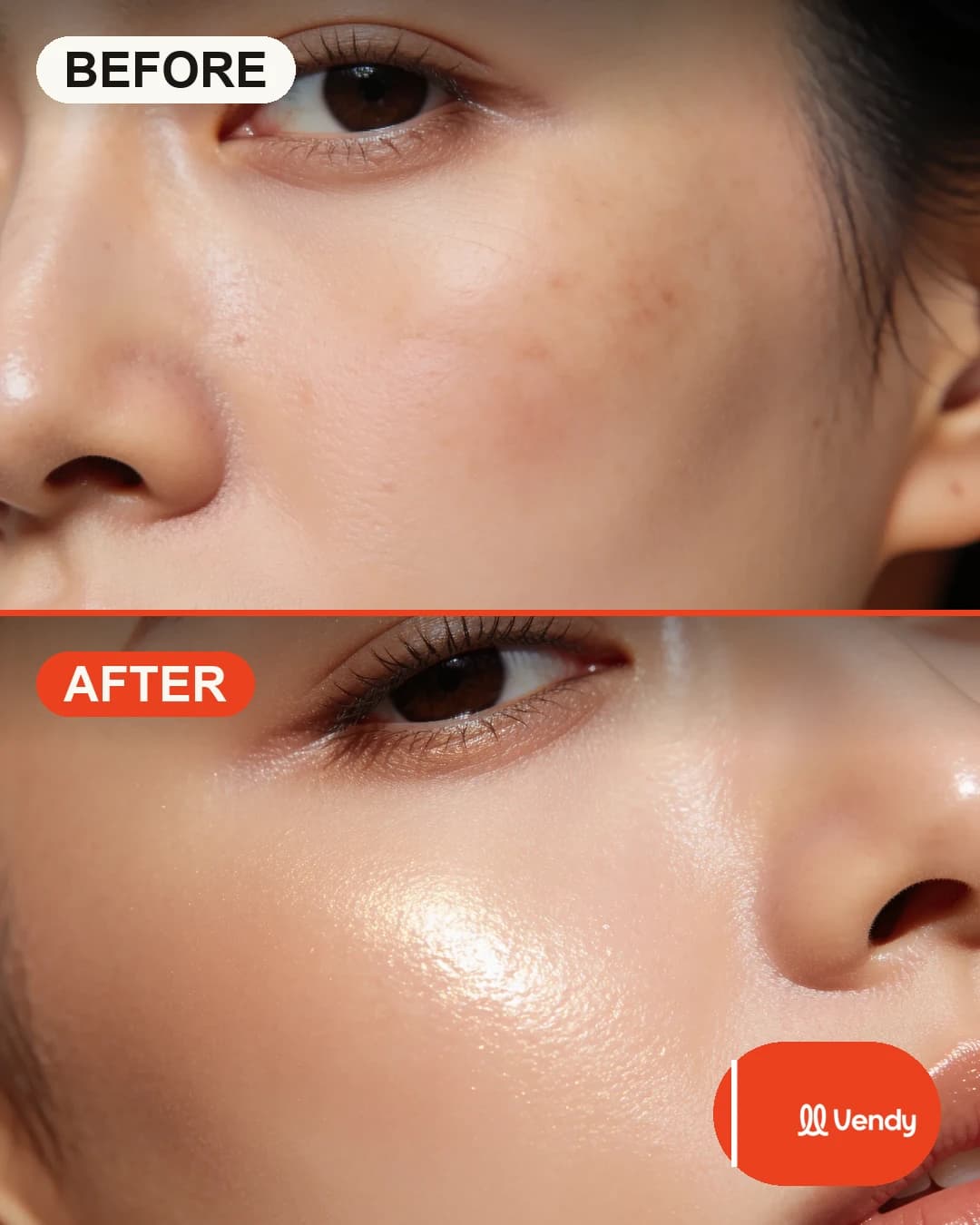Before / after creative — a skincare glow-up, Vendy-branded